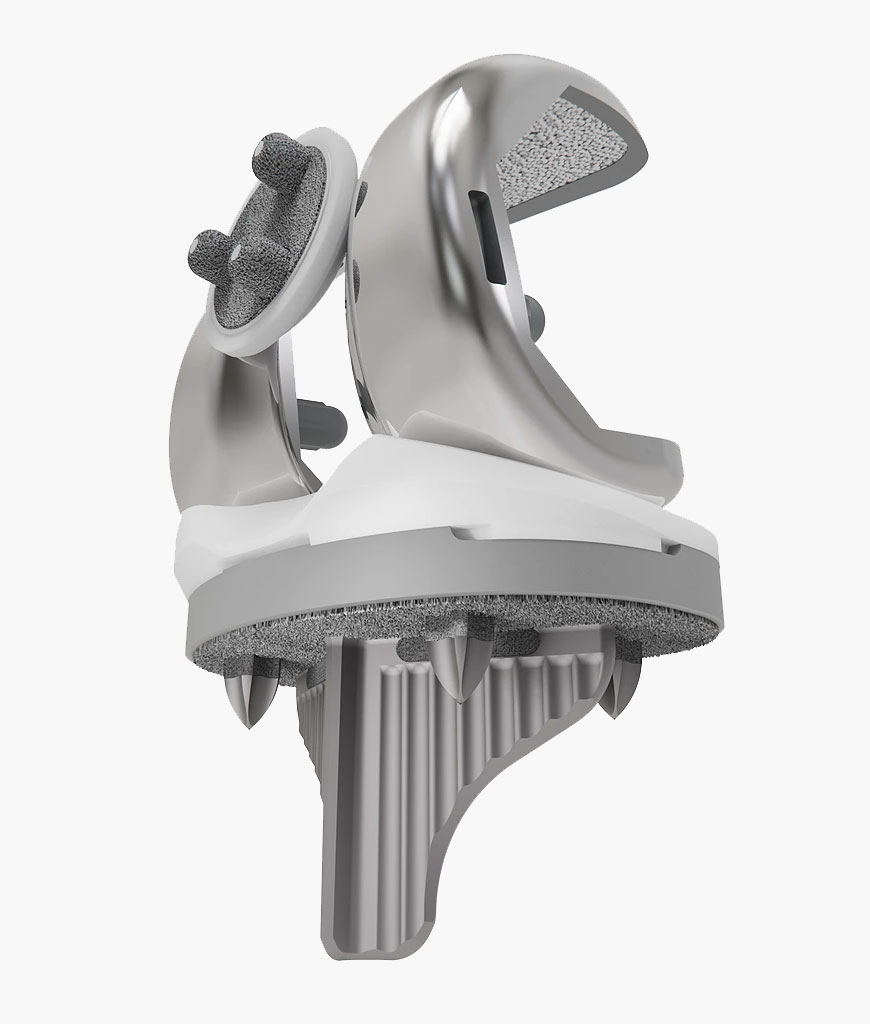 Triathlon Cementless implant copyright Stryker
